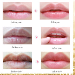 Labial membrane - Otaj Gifts
