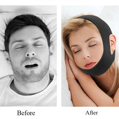Anti Snore Belt Stop Snoring Chin Strap Woman Man Night Sleeping Support Aid Tools Snoring Protection Jaw Bandage Health Care - Otaj Gifts