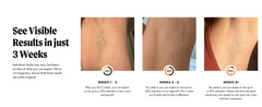IPL Hair Removal Unlimited Flashes Laser Ice-Cooling Painless Whole Body Treament Safe & Effecctive Home Beauty Device Men Women - Otaj Gifts