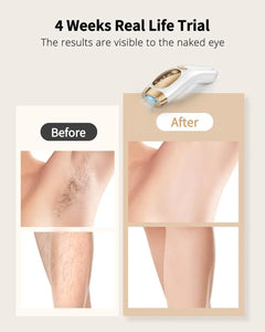 IPL Hair Removal Unlimited Flashes Laser Ice-Cooling Painless Whole Body Treament Safe & Effecctive Home Beauty Device Men Women - Otaj Gifts