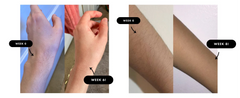 IPL Hair Removal Unlimited Flashes Laser Ice-Cooling Painless Whole Body Treament Safe & Effecctive Home Beauty Device Men Women - Otaj Gifts
