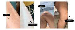 IPL Hair Removal Unlimited Flashes Laser Ice-Cooling Painless Whole Body Treament Safe & Effecctive Home Beauty Device Men Women - Otaj Gifts