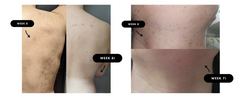 IPL Hair Removal Unlimited Flashes Laser Ice-Cooling Painless Whole Body Treament Safe & Effecctive Home Beauty Device Men Women - Otaj Gifts