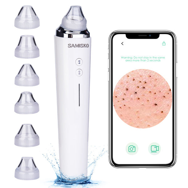 Vacuum Blackhead Analyzer With 6 Suction Heads - Otaj Gifts