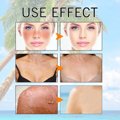 Hyaluronic Acid Moisturizing Protective Gel Summer Outdoor Moisturizing Refreshing Not Oily Resist Ultraviolet Rays - Otaj Gifts