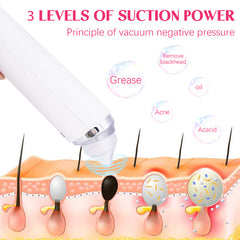 Vacuum Blackhead Analyzer With 6 Suction Heads - Otaj Gifts