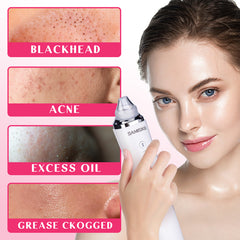 Vacuum Blackhead Analyzer With 6 Suction Heads - Otaj Gifts